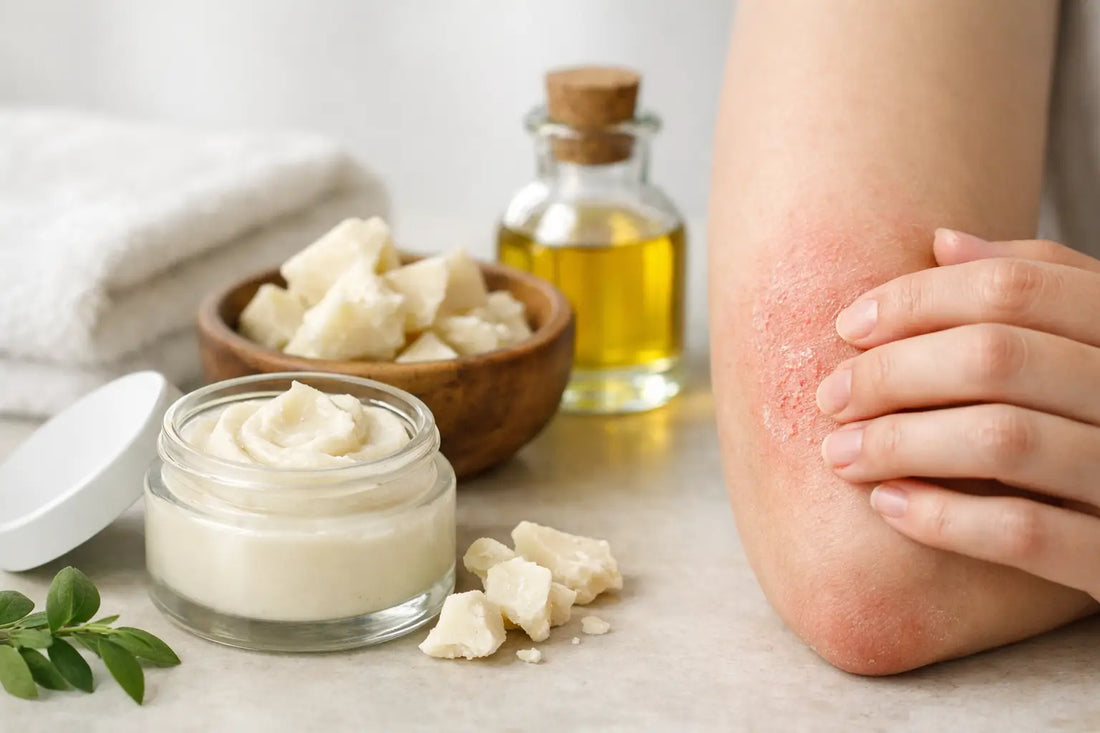 Tallow Balm for Eczema-Prone Skin