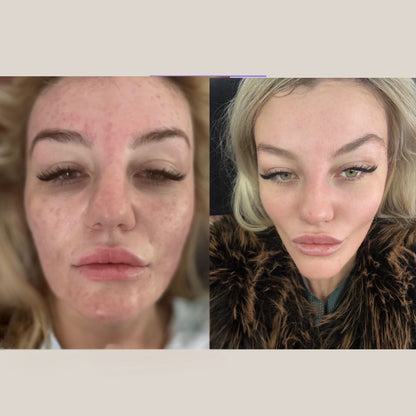 Night Restore | Overnight Tallow Serum for Dry Skin