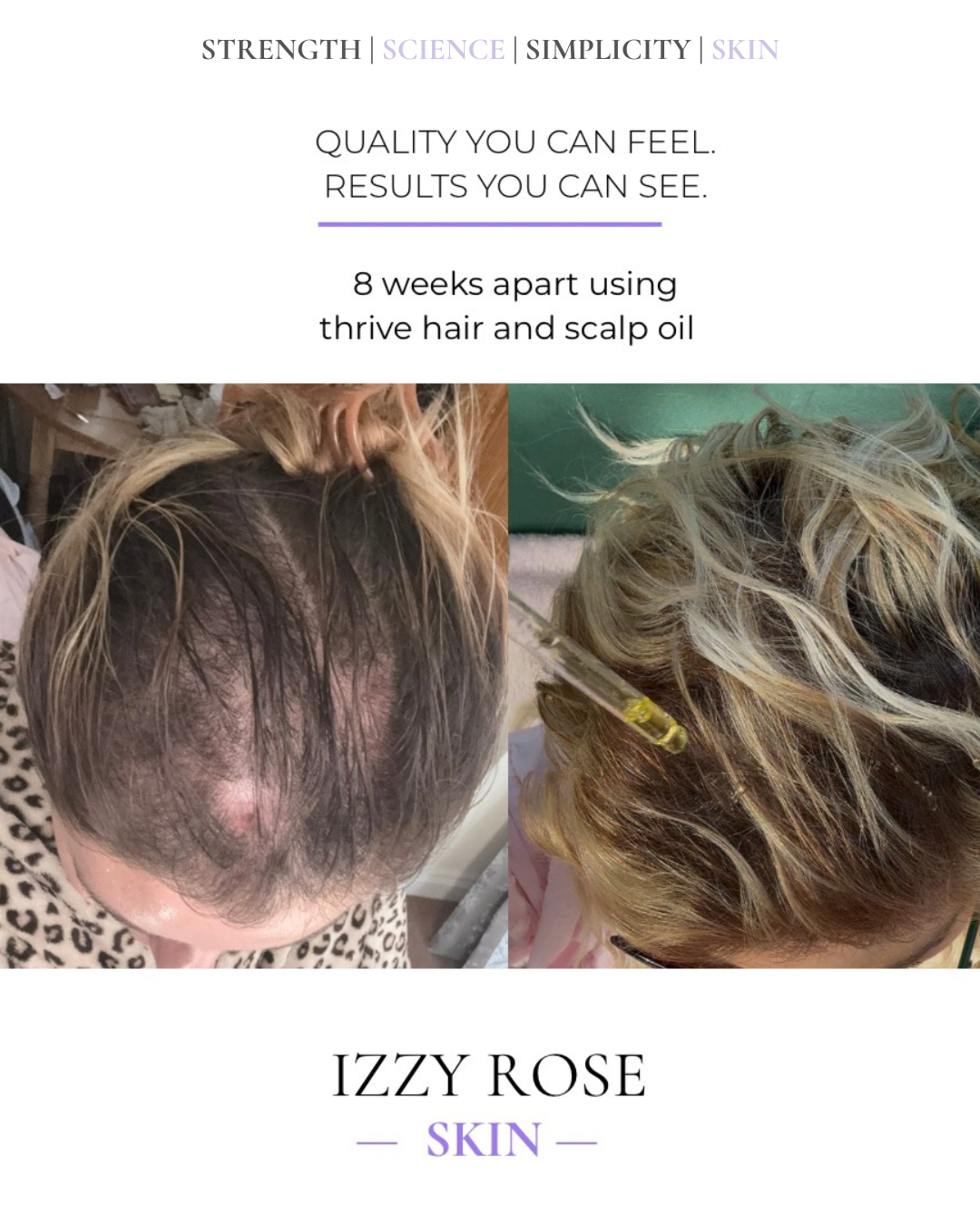 Hair + Skin Glow Set